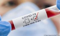 Държавата купува два медикамента от Китай за лечение на коронавирус